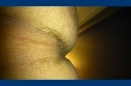 fesse 0423