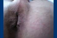 fesse 0430