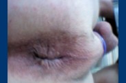 fesse 0434