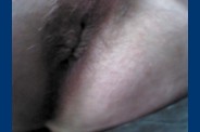 fesse 0436