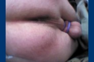 fesse 0440