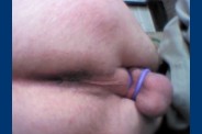 fesse 0441