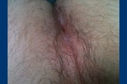 photo (14)
