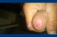 sirop 0375