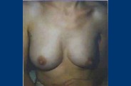 C33-3