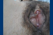 dscg00795