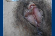 dscg00799