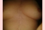alpha 039