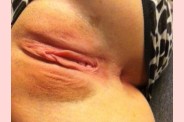 BTE 113 (36)