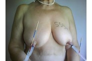 11-seringue.jpg
