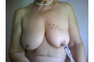 9-seringue.jpg