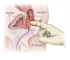 prostate-massage.jpg