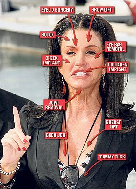 chirurgie-janice-dickinson-plastic-surgery-addiction.jpg