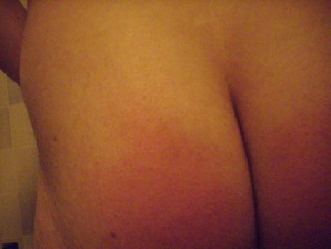 les fesses apres les 40 coups