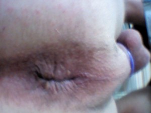 fesse 0434