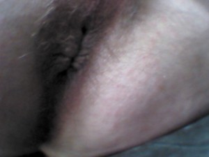 fesse 0436