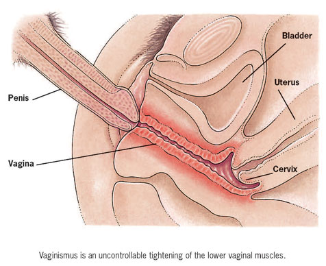 dico-penis-in-vagina.jpg