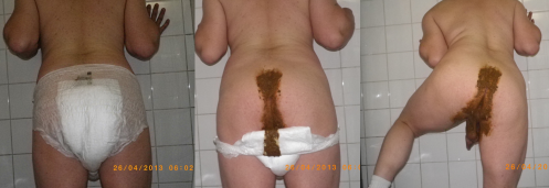 scat.png