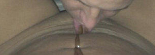 4b