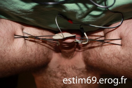 e-stim5