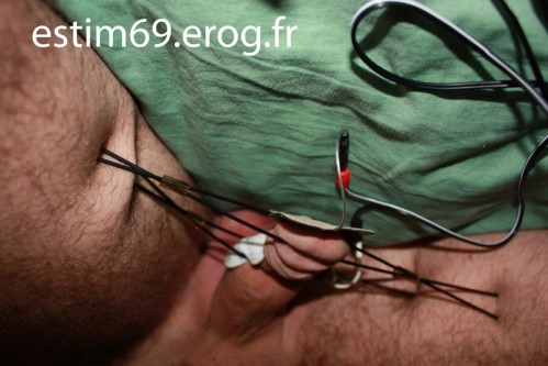 e-stim6