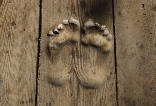 tibet-pieds-graves