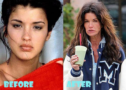 chirurgie-Janice-Dickinson-Plastic-Surgery-Before-and-After.jpg