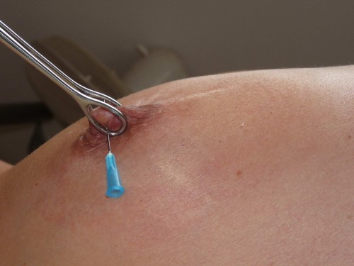 amateur-needle-pain-05.jpg