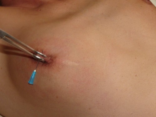 amateur-needle-pain-06-copie-1.jpg