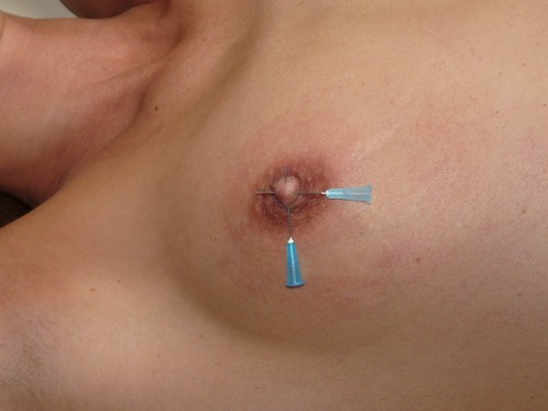 amateur-needle-pain-09.jpg