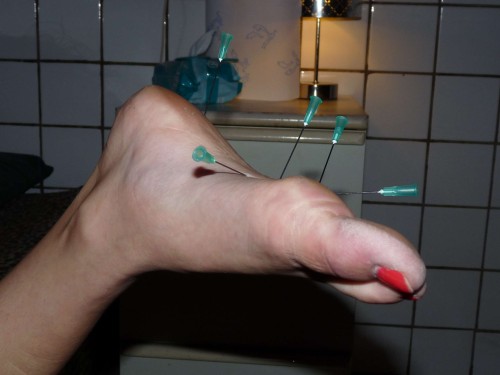 amateur-needle-pain-14.jpg