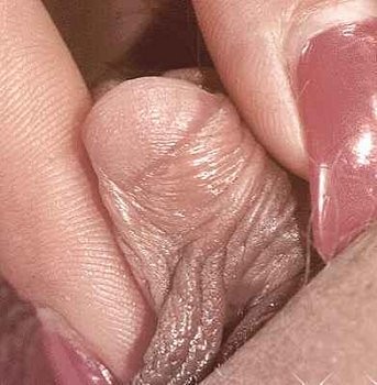 clitoris-34