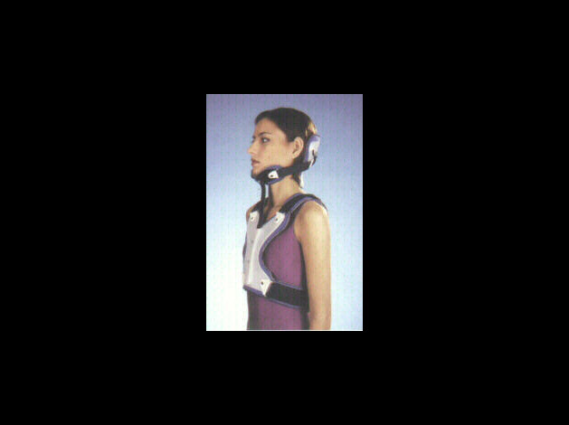 2-post-collar2.jpg