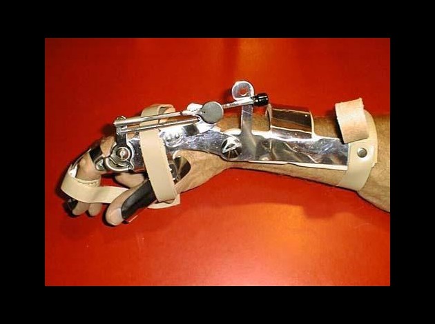 hand_brace.jpg