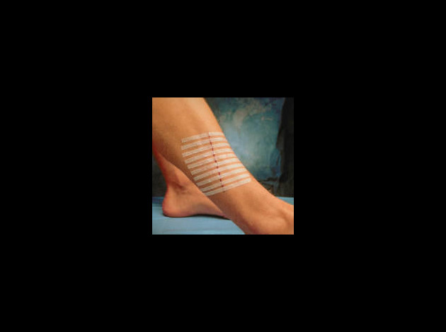 3m-steristrip.jpg