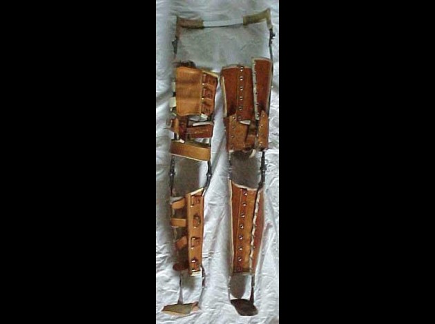 leg_brace_vintage.jpg