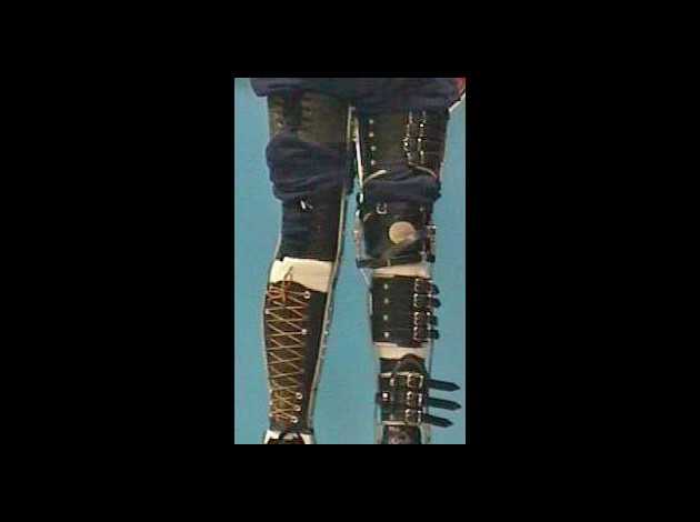 legbracedif.jpg