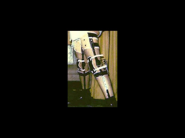 legbraceman.jpg