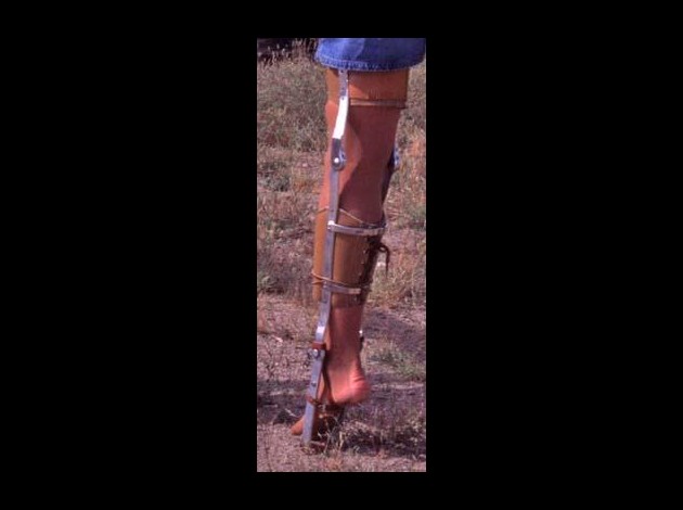 legbracewoman.jpg