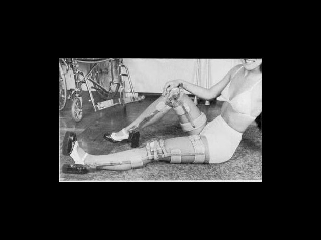 legbracewoman3.jpg