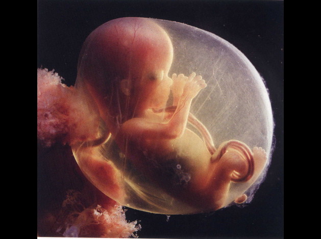 foetus-2015semaines.jpg