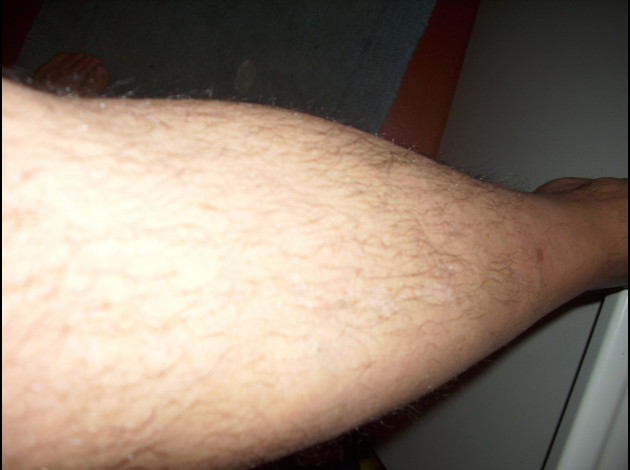cuisse avant rasage