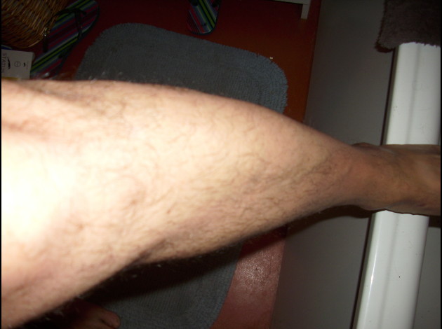 jambe avant rasage