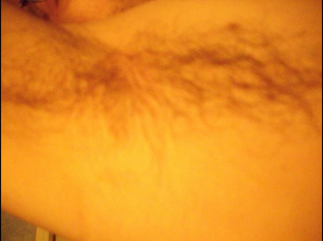 dessous de bras avant rasage 2