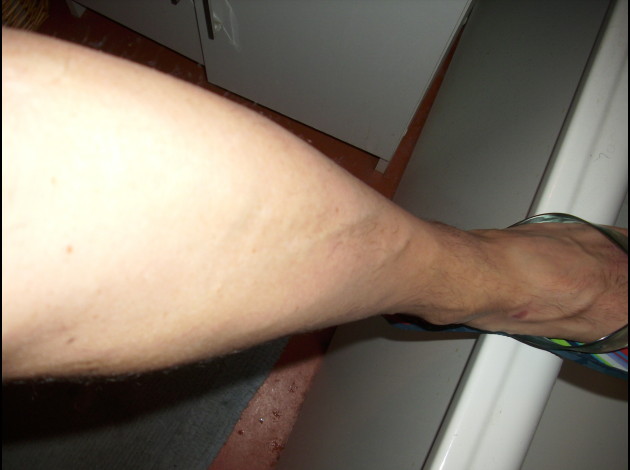 jambe apres rasage