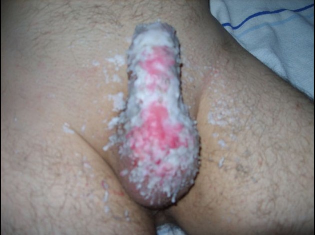 K00402