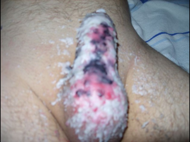 K00403