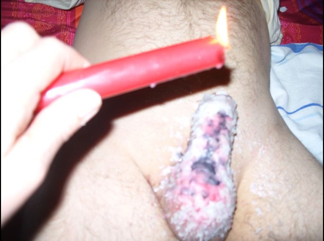 K00405