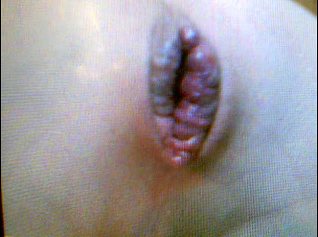 2010-03-05-35737