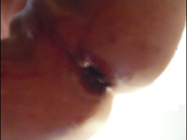 my-opened-asshole.jpg